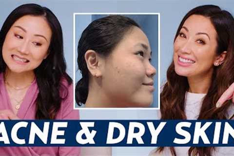 Best Skincare Routine for Acne &amp; Dry Skin? Dermatologist Advice for Lisa! | DERMATOLOGIST REACTS