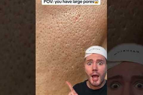 HOW TO GET RID OF LARGE PORES!😱 (follow for more!💗) #acne #skincareroutine #skincare #skin #beauty