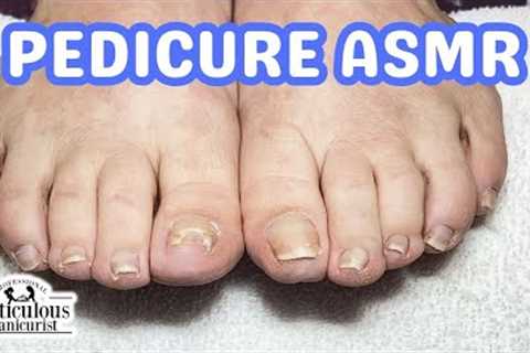 👣ASMR Pedicure Cleaning💆‍♀️Big Toenail Repair Pedicure Tutorial at Home👣