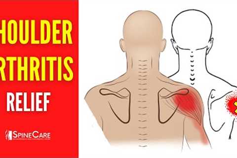 How to Relieve Shoulder Arthritis Pain in 30 SECONDS