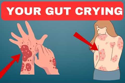 Poor Gut Health: 7 Signs That Your Gut is Crying for Help