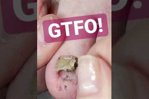 Get the funk out! Cleaning under lifted nail. #meticulousmanicurist #gtfo #cleaning #pedicure