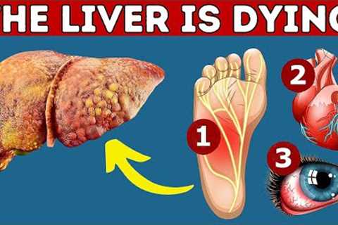 Liver function and Liver problem symptoms | 7 Symptoms You Should Never Ignore.