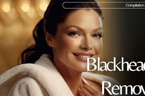 Skincare | Blackheads Removal #073 #skincare skincare #blackheads blackheads