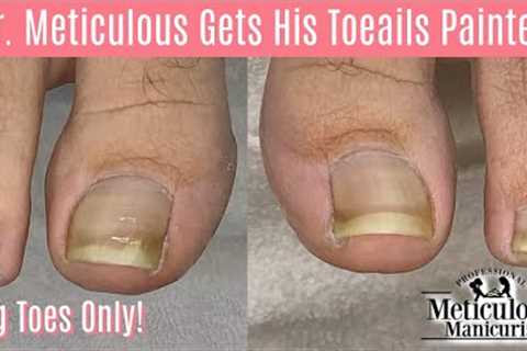 👣Big Toes Only - Ingrown Toenail & Impacted Toenail Pedicure: Relief, Causes and Prevention👣