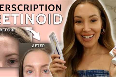 How my Skin Has Changed From Prescription Retinoid