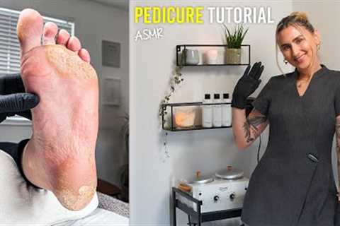 Restoring The Hardest Working Feet Iv'e Ever Seen Back To Life