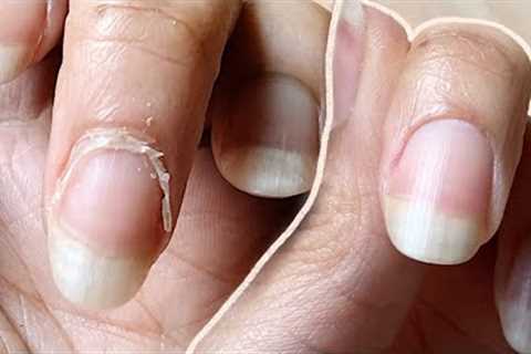 NAIL TRANSFORMATION | how I CUT CUTICLES at  HOME | Basic Tools ONLY
