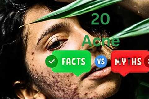 Acne Myths You Might Have Been Told Or Heard That Are Liars