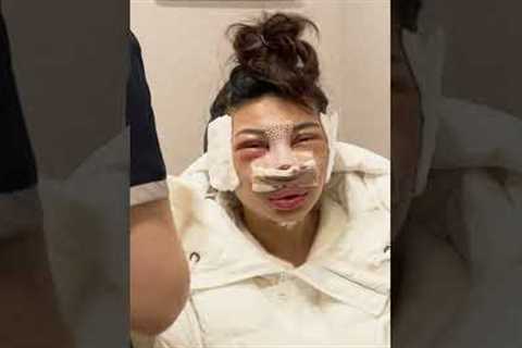 undergoing a facial contouring surgery in korea😱😱😱