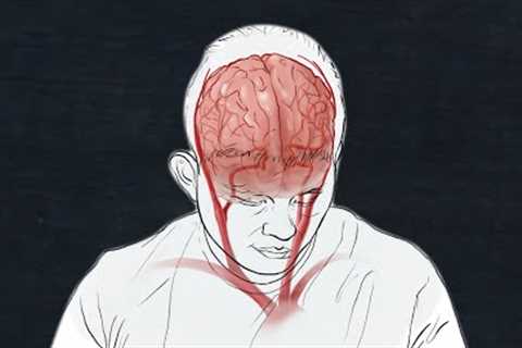 Here’s what we know about COVID-19’s impact on the brain