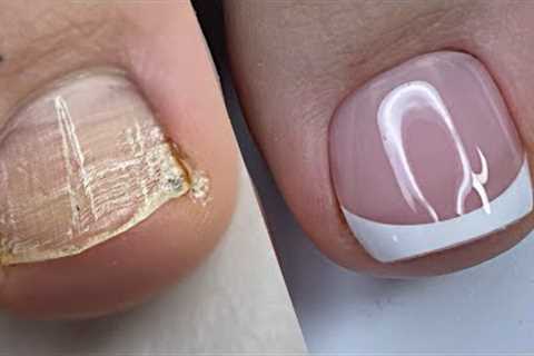 Amazing Pedicure Transformation 🦶X-coat Tips by BTArtbox