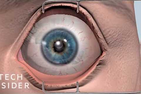8 Medical Procedures That Are Improving Lives
