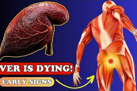 LIVER is DYING! 12 Weird Signs of LIVER DAMAGE | Health care