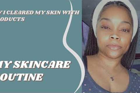 SKINCARE ROUTINE (How I Cleared My Acne Prone Skin With 3 Products)#skincare #skincareroutine #vlog