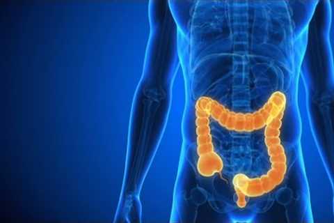 Eating Healthy with Crohn’s Disease