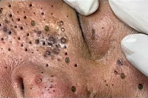 Enjoy Every Day With The Best Video Loan Nguyen Spa # 2461