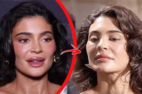 Top 10 Celebrities Who Destroyed Their Face With Plastic Surgery