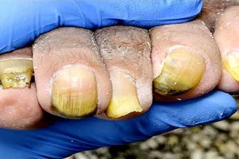 The Complete Pedicure Process A Thorough Treatment【Podiatry Clinic】