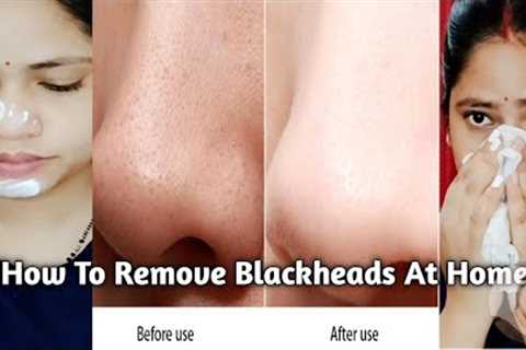 How To Remove Blackheads &amp;Whiteheads ||5 Hacks to get Rid of Blackheads in 1day!  #homeremedies