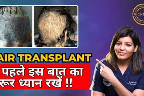 5 Essential Tips to Know Before Considering a Hair Transplant! | Hair Transplant Clinic