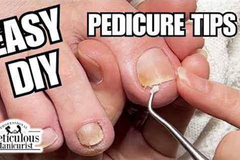 👣Beginner Pedicure Tutorial: Clean Yellow Toenails at Home #nails #satisfying