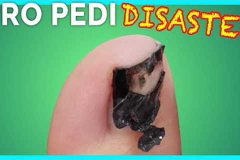 Shocked By Pricey Pedicure Results 😱