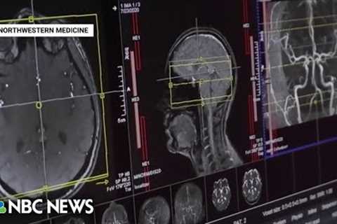 New findings offer more answers on long Covid