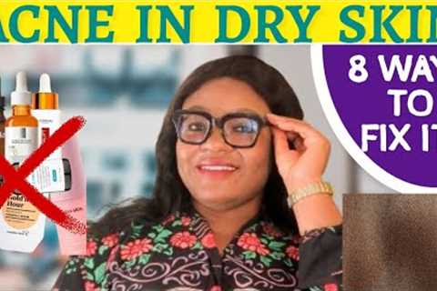 8 STEPS TO REMOVE ACNE FROM DRY &amp; TEXTURED SKIN | Best Acne Treatment For Dry Skin - Simply..