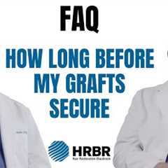 FAQ: How long after my hair transplant are my grafts secure? - Hair Restoration Blackrock