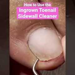 How to use the Ingrown Toenail Sidewall Cleaner #ingrowntoenail #pedicure #meticulousmanicurist