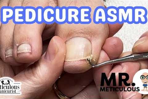 👣ASMR Pedicure Cleaning💆‍♀️ Epic Impacted Toenail Debris Removal on Mr. Meticulous👣