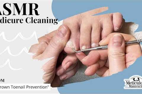 👣ASMR Pedicure Cleaning💆‍♀️Ingrown Toenail Prevention👣