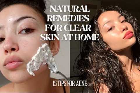 HOW TO MAINTAIN CLEAR SKIN WITHOUT SPENDING MONEY | 15 tips and tricks for acne
