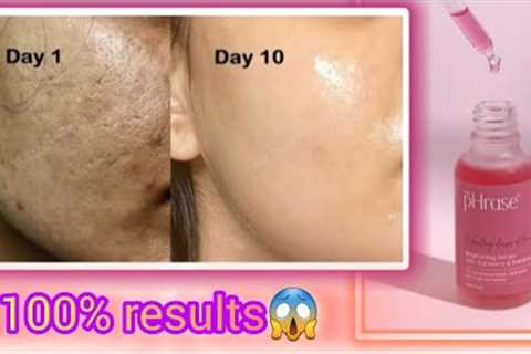 how to get rid of acne overnight• phrase serum genuine review #trending #skincare #taehyung