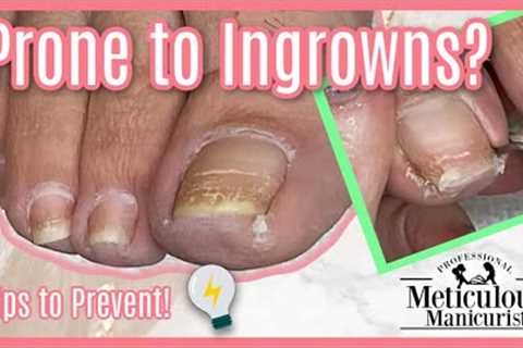 How to Prevent Ingrown Toenails in a Relaxing ASMR Pedicure