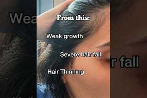 My hair journey: Here’s how I went for hair fall and thinning to thick long hair. #haircare