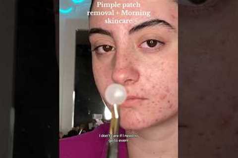 MORNING SKINCARE FOR ACNE PRONE SKIN #beautytips #acnepositivity #skincare #grwmroutine