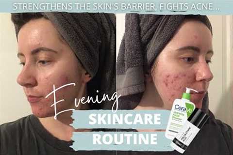 Evening Skincare Routine FOR ACNE-PRONE SKIN | The Ordinary, CERAVE, The Inkey List