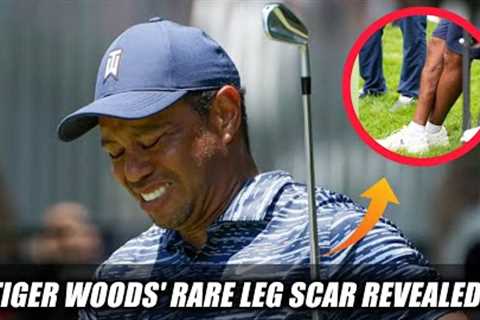 Tiger Woods' Leg Scar Revealed at Golf Tournament