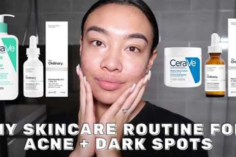 SKINCARE ROUTINE FOR ACNE + DARK SPOTS *NOT UP TO DATE ANYMORE* | SAMANTHAEVIRA