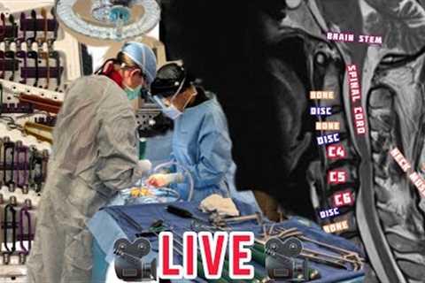 LIVE: Spine Post-OP Recovery
