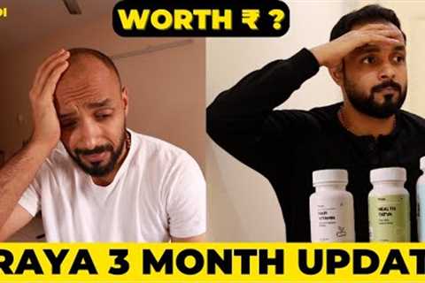 ✅ Traya Hair Regrowth👩‍🦲3 Month Progress Update 👉 My Honest Opinion 🟡 from hair loss to Thicker ..