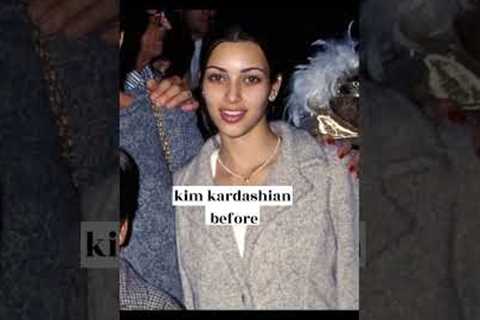 kardashians before and after surgery #shorts #edit #kardashian #kylie  #kimkardashian  #kendall