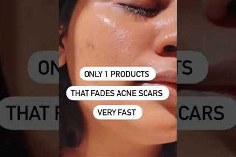 Only 1 product that fades Acne scars/Dark spots very fast #shorts #acnescars #darkspots