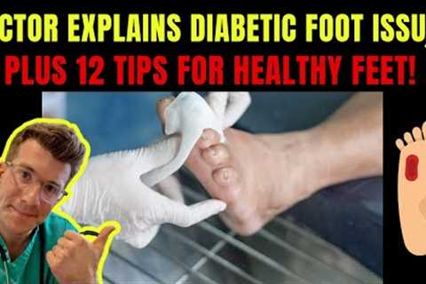 Doctor explains DIABETIC FOOT COMPLICATIONS - PLUS 12 TIPS FOR PREVENTION!