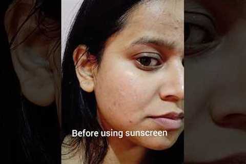 Before Vs After using sunscreen for a month #shorts #skincare #youtubeshorts #aqualogica