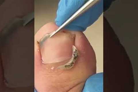 Satisfying pedicure video! #pedicure