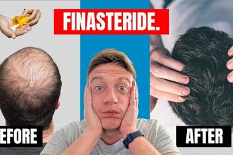 PEOPLE GOT THESE RESULTS WITH FINASTERIDE ALONE?! | REVIEW