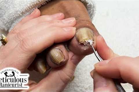 Pedicure Tutorial: How to Relieve Pain in Your Toenails